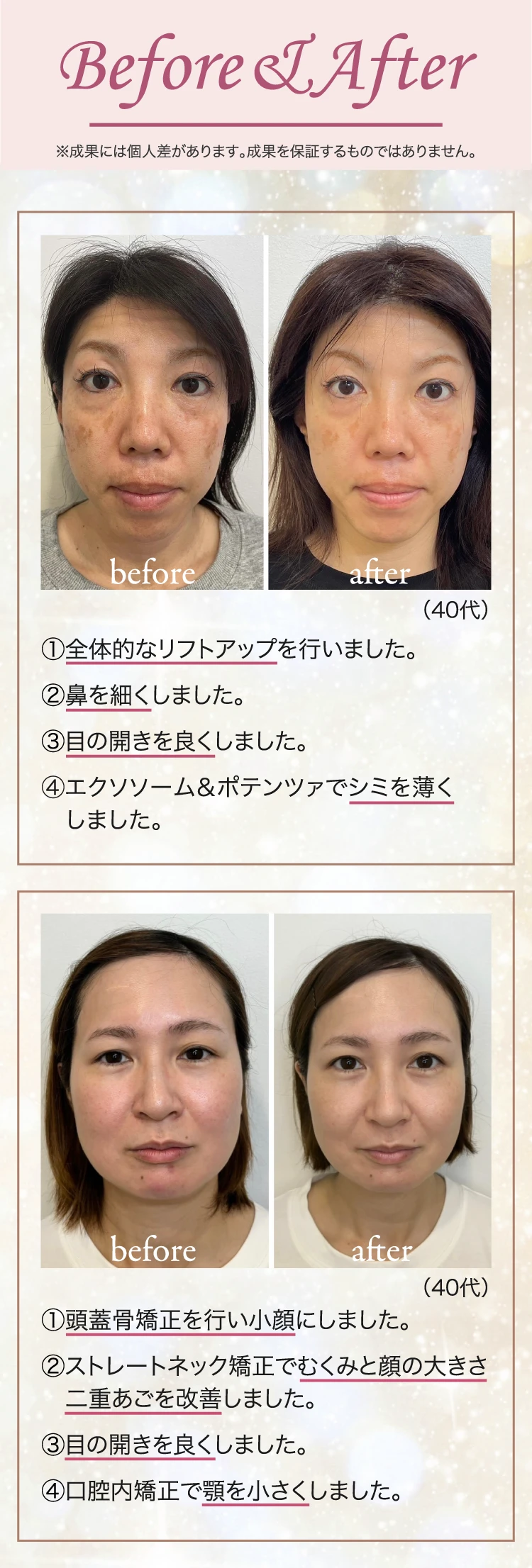 Before & After